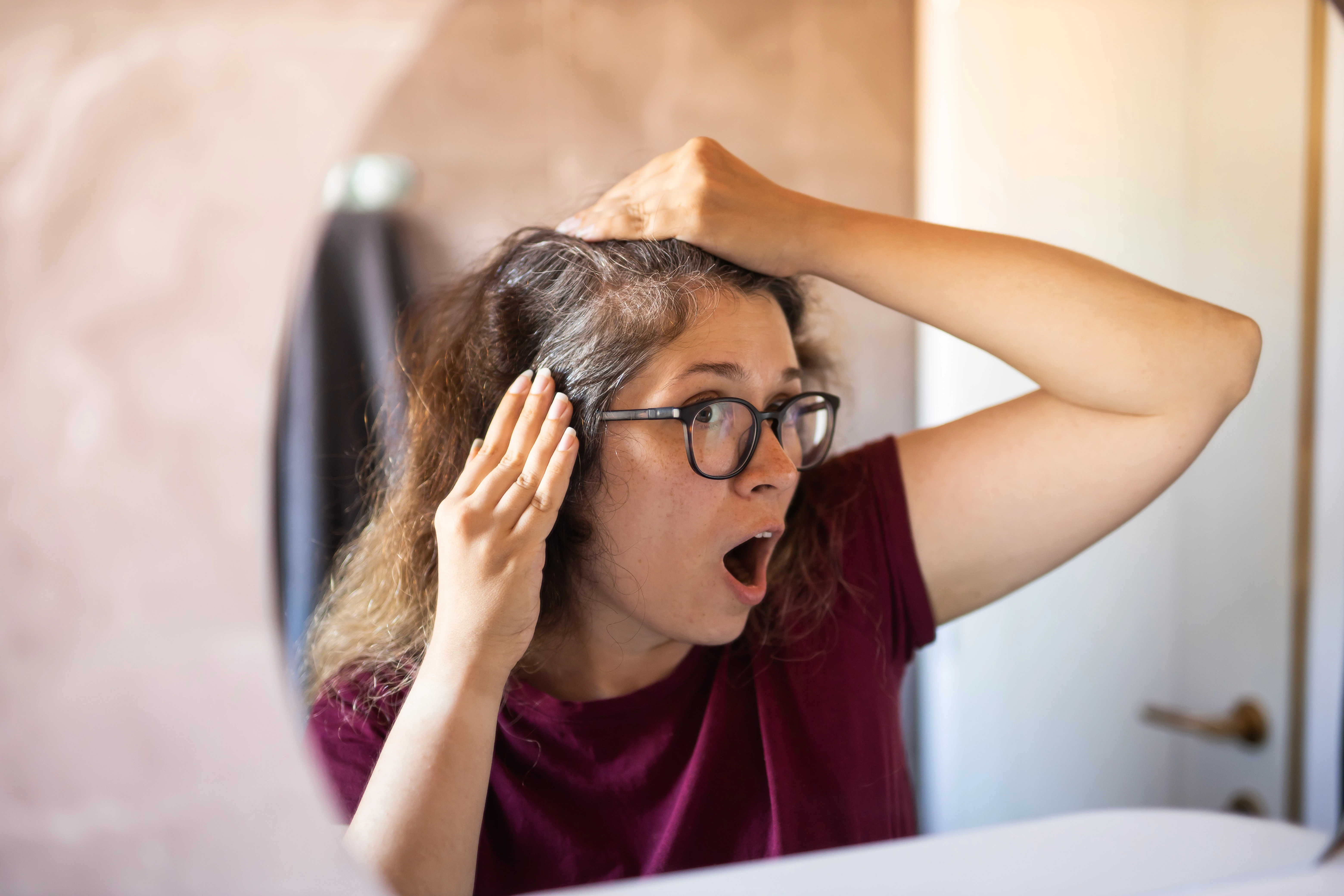 Protocolo para las canas prematuras