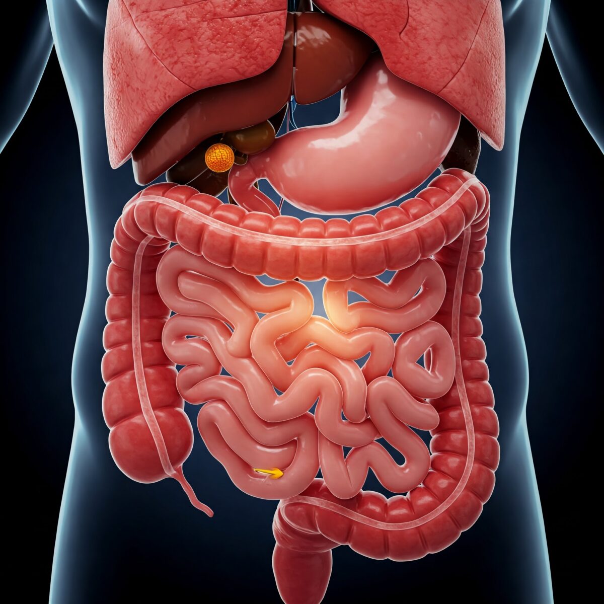 SÍNDROME DEL INTESTINO PERMEABLE: SU IMPLICACIÓN EN LA INSUFICIENCIA Y FALLO MULTIORGÁNICO